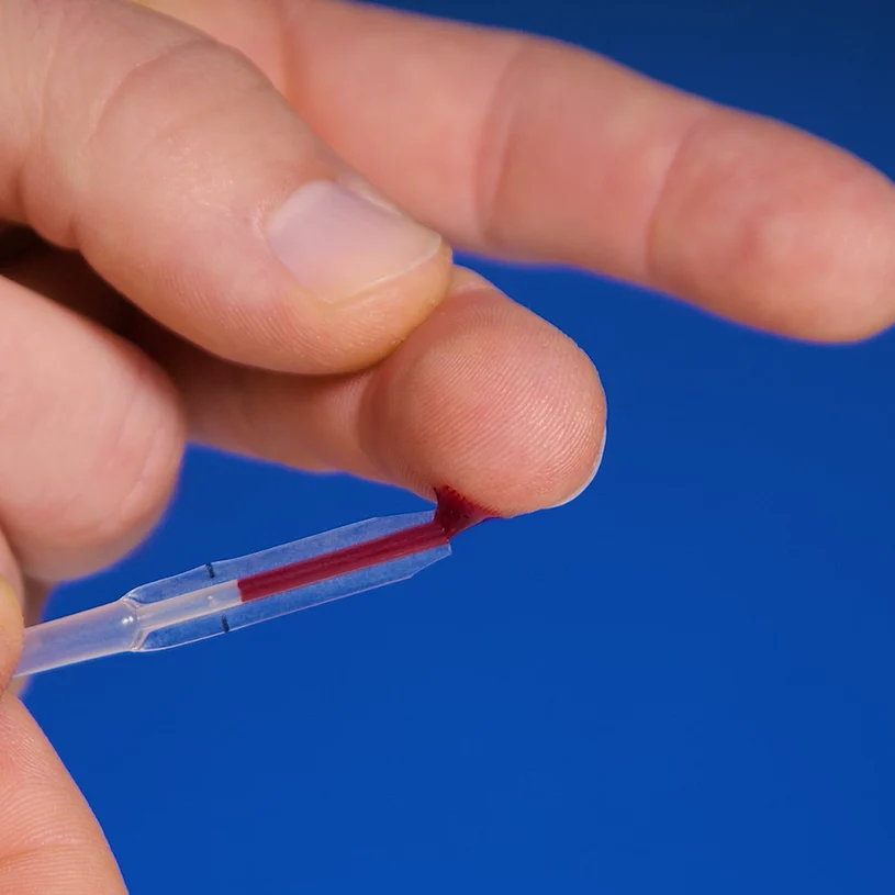 Autotest d’allergie Patris Health – étape 2, prélèvement d’une goutte de sang au bout du doigt avec la pipette