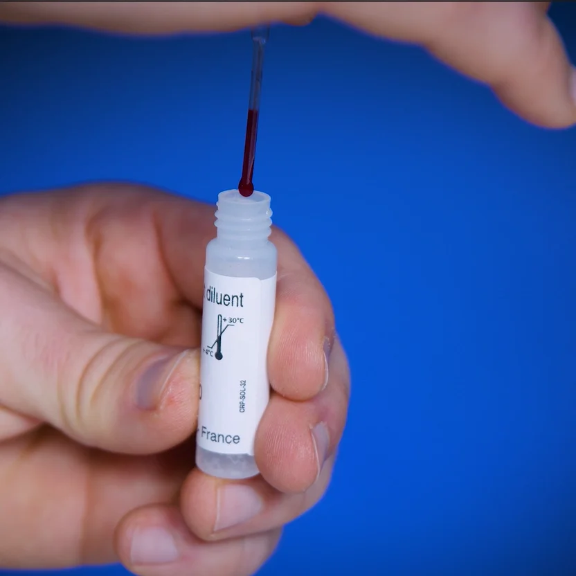 Autotest de la protéine C-réactive Patris Health – étape 3, transfert du sang dans le flacon compte-gouttes de diluant
