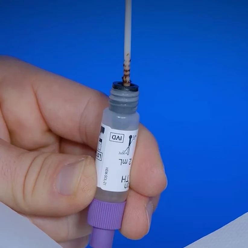 Autotest de calprotectine Patris Health – étape 2, bâtonnet de prélèvement réintroduit dans le flacon contenant la solution d’extraction