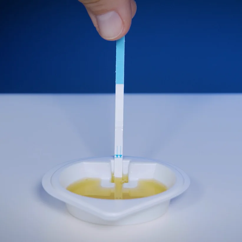 Échantillon d’urine : la bandelette placée verticalement dans la coupelle