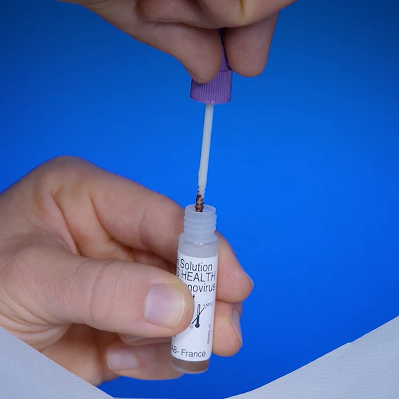 Autotest de rotavirus et adénovirus Patris Health – étape 2, bâtonnet de prélèvement réintroduit dans le flacon contenant la solution d’extraction